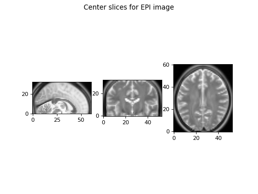 _images/neuro_radio_conventions-2_00.png